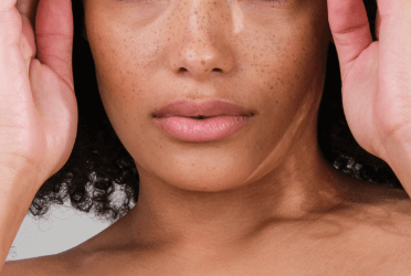 3 ways to calm stressed skin